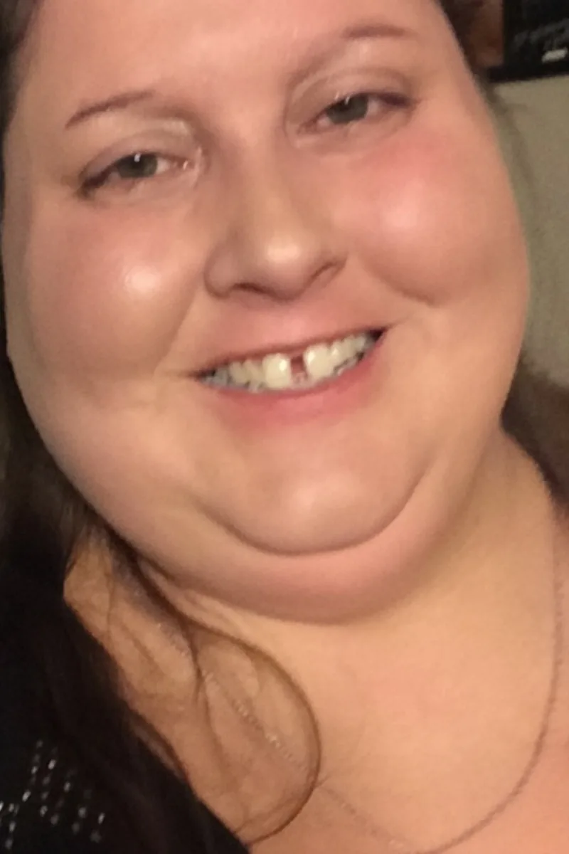 Lynette