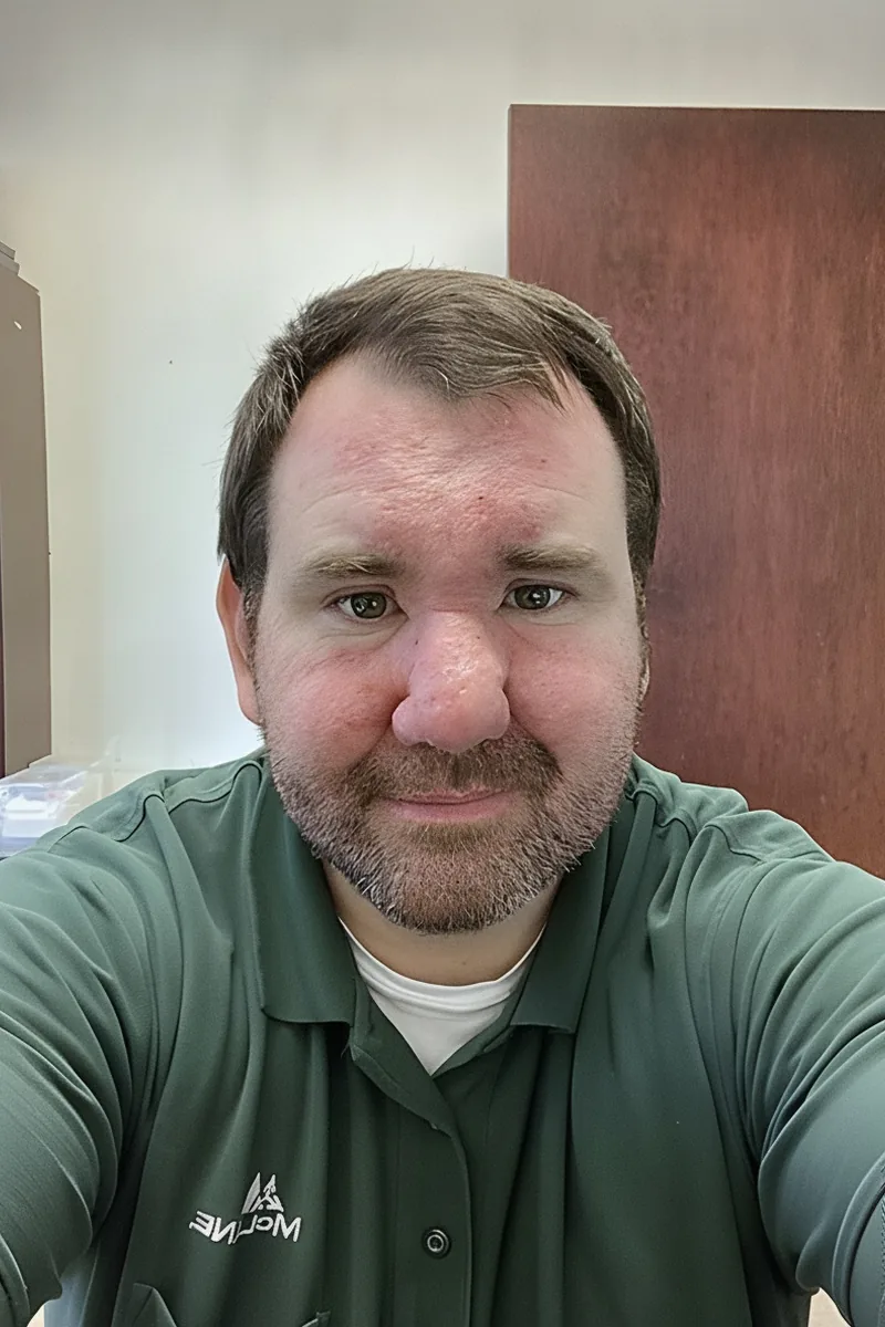 Nick